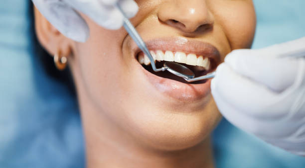Emergency Dentist for Kids in LA